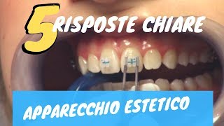 5 risposte CHIARE sull&#39;apparecchio ESTETICO