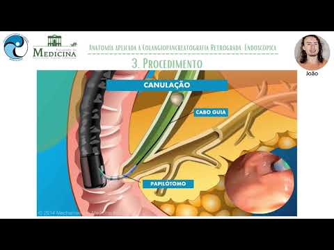 AMC 1/2021 - 10 - ANATOMIA APLICADA À COLANGIOPANCREATOGRAFIA RETRÓGRADA ENDOSCÓPICA (CPRE)