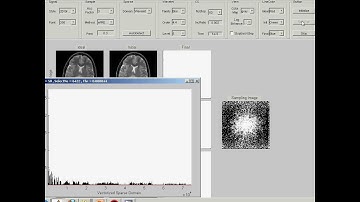 Compressed Sensing Simulation