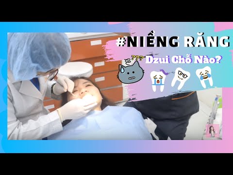 NIỀNG RĂNG CÓ