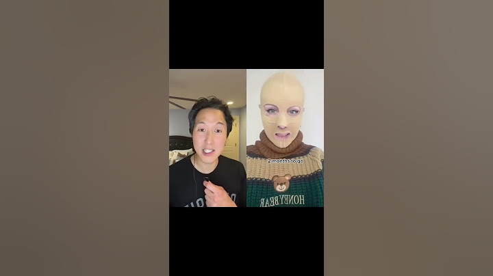 重度の火傷を負った後の顔の公開 ― なんとも感動的！ #shorts #burnsurvivor
