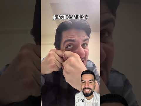 QUISTE SEBÁCEO