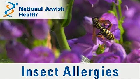 Insect Sting Allergies: What You Need to Know