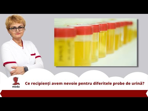 Ce recipienți avem nevoie pentru diferitele probe de urină?