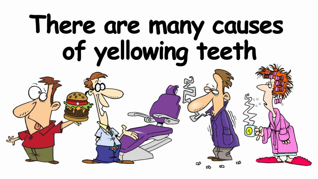 Professional Teeth Whitening in Jupiter Florida YouTube