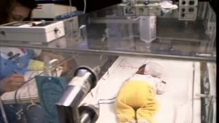 PREMATURE BABIES.- Deaths.