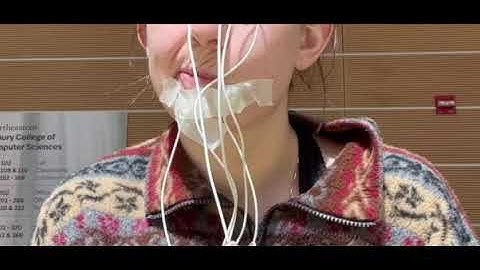 Facial EMG Movement Example