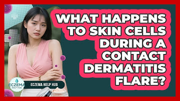 What Happens To Skin Cells During A Contact Dermatitis Flare? - Eczema Help Hub