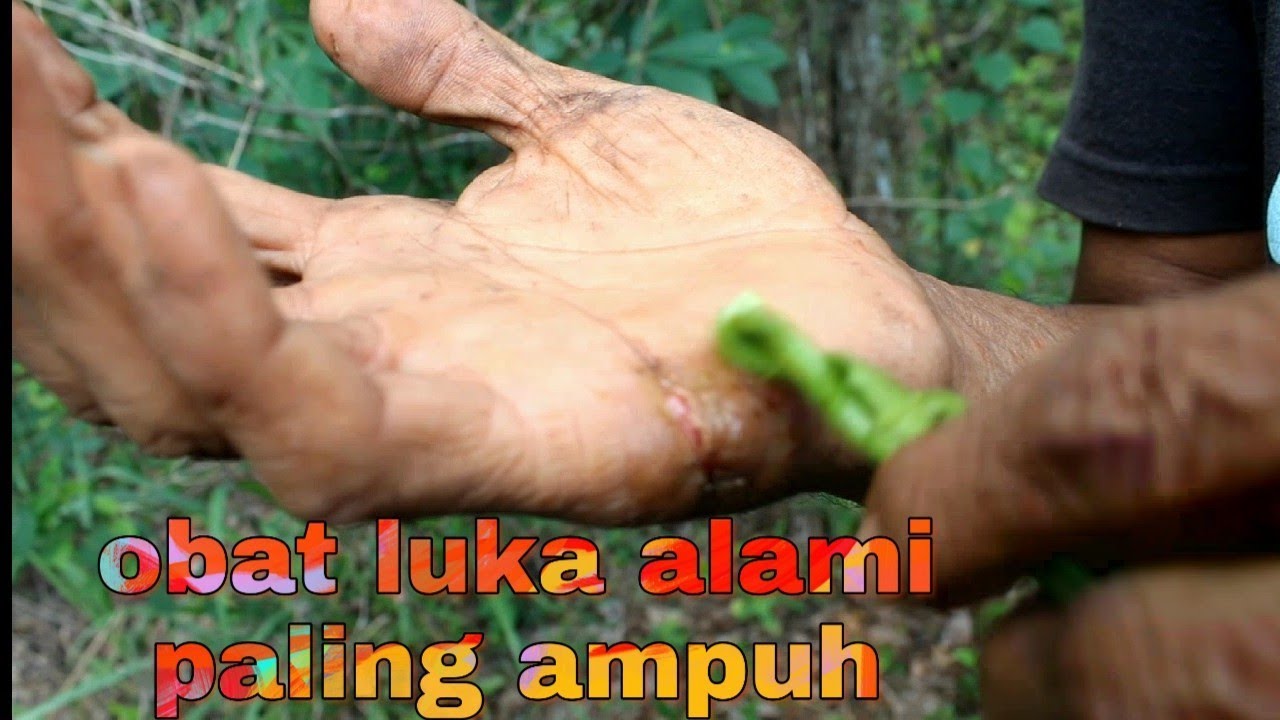 OBAT LUKA ALAMI PALING AMPUH 