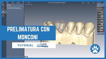 Prelimatura con monconi con Cad Lynx Evolution