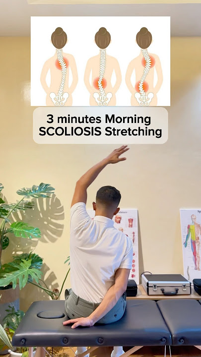 3 minutes Morning Scoliosis Stretching!! — #scoliosis #scoliosistherapy #scoliosistreatment