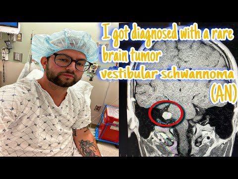 My Story being diagnosed with a Rare Brain Tumor, Vestibular Schwannoma (Acoustic Neuroma)