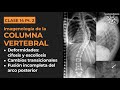 14.2 -  Imagenología de columna: Deformidades (cifosis y escoliosis) y cambios transicionales