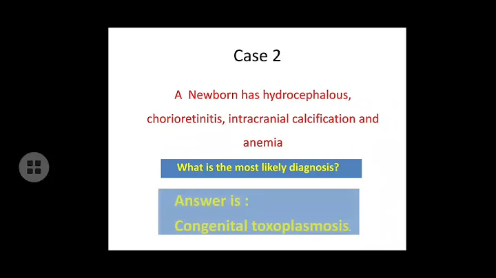 Neonatology, Congenital infections lecture by Dr. ...