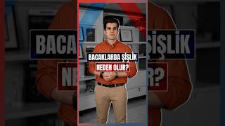 Bacaklarda Şişlik Neden Olur? Resimi