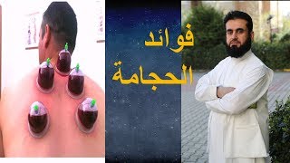 فوائد مهمة ونافعة للحجامة