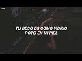 Kygo, Miguel - Remind Me to Forget (Traducida al Español)