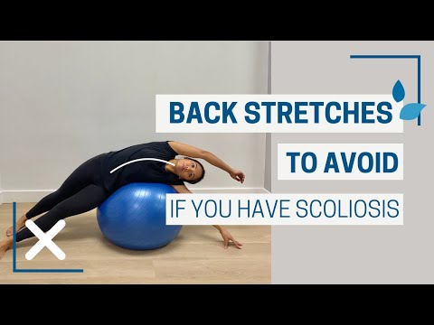 Back Stretches To AVOID If You Have Scoliosis (And Why)