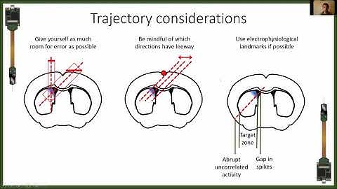 2020 Lecture 1.07 - Planning a Neuropixels trajectory - Andy Peters (UCL)