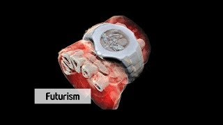 3D Color X rays