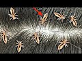 सिर की जुएं (lice)और लिखें (Nits) 1 बार में ख़तम | बालों के लिए | Head Lice & Nits Removal at home