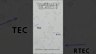 현미경속 신기한 소변세계6 Tec
