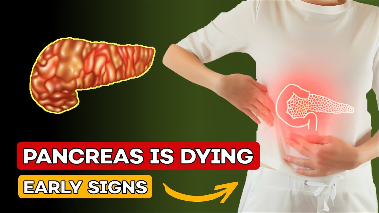 PANCREAS Is DYING 12 Weird Signs Of PANCREATIC CANCER YouTube PANCREAS Is DYING 12 Weird Signs Of PANCREATIC CANCER YouTube