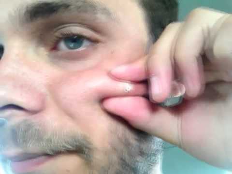 vinagre de manzana cura la impotencia