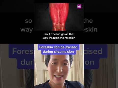 Doctor Reacts To World S Longest Weiner Doctorreacts 
