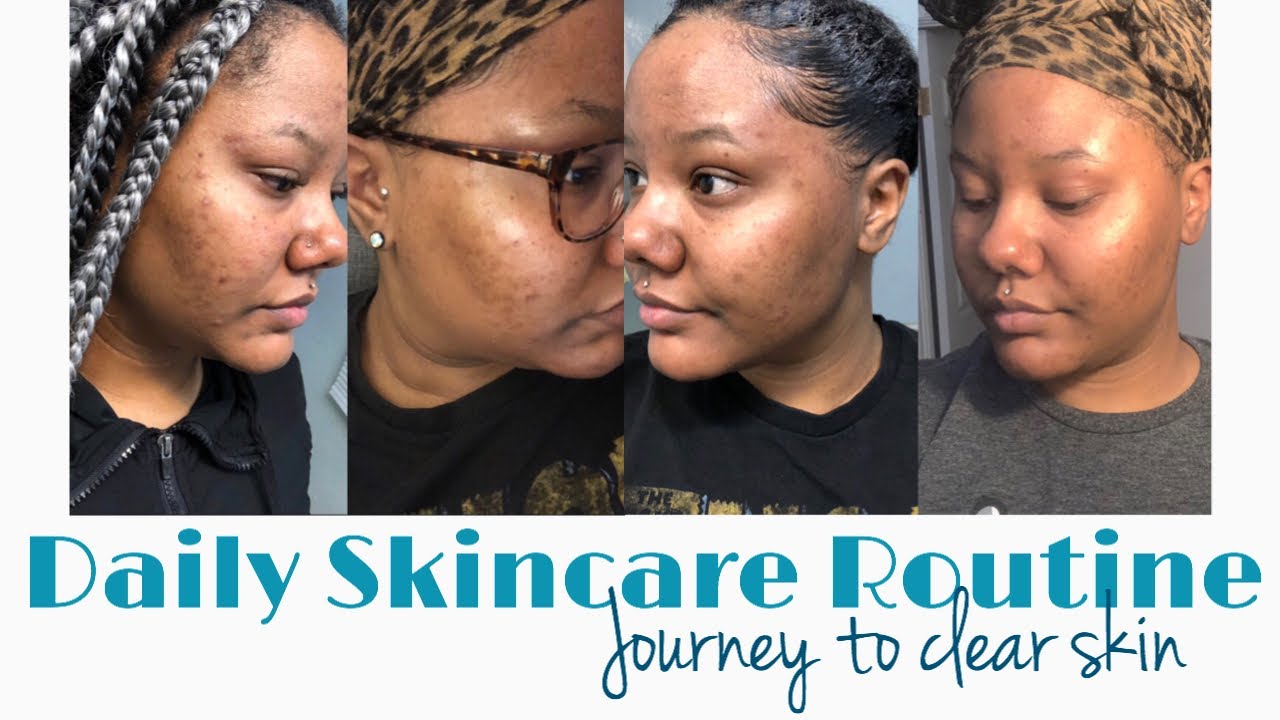Skin care Routine| Journey to clear skin - YouTube