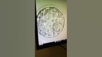 ASSISTED SHRINKAGE #IVF #blastocyst #embryo #vitrification #laser #science #education #embryologist