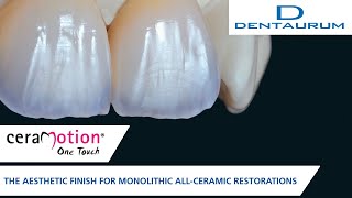 ceraMotion® One Touch for the finish of monolithic all-ceramic restorations