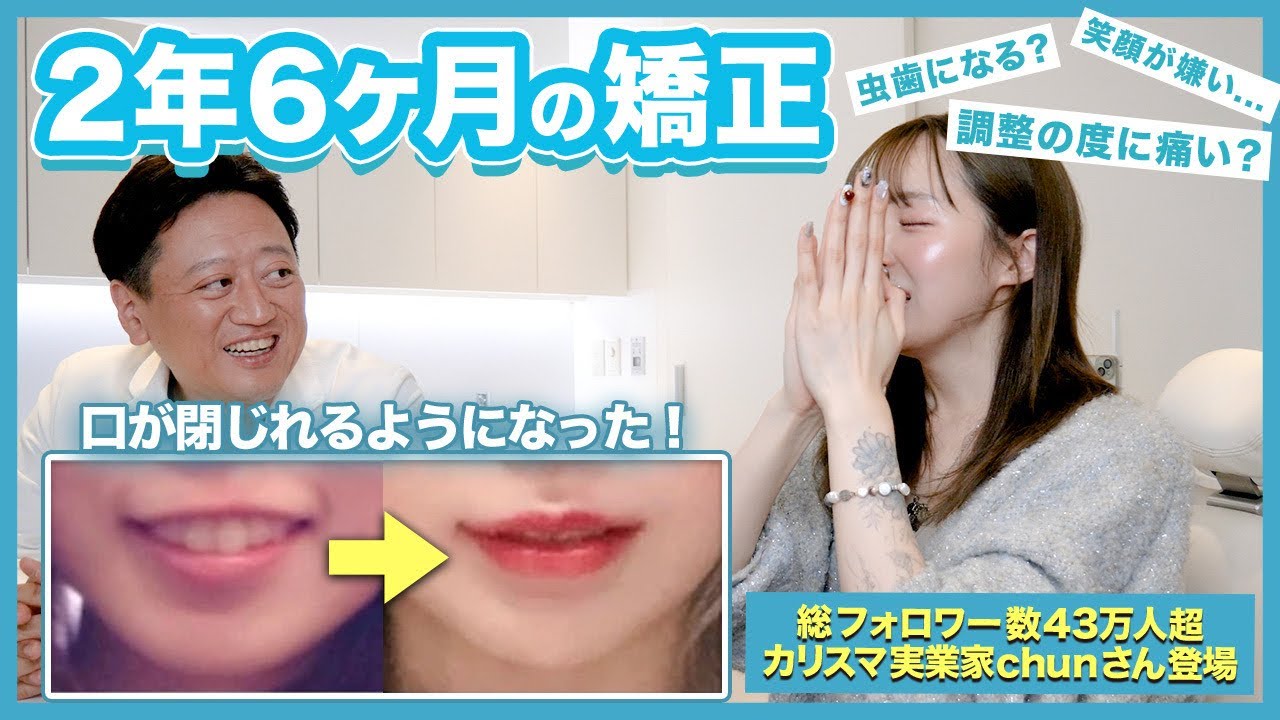 歯 列 矯正 美人 に なっ た