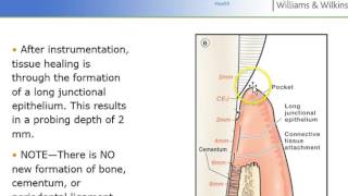Non-surgical Periodontal Therapy NSPT - Perio Ch 24 Lect I