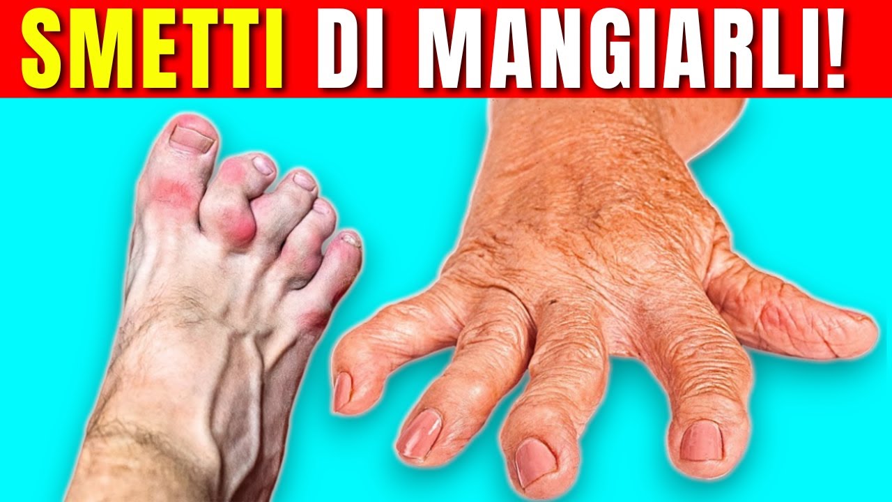 ARTRITE - 6 CIBI che non dovresti mangiare MAI PIÙ - YouTube