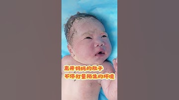 #shorts#newborns #baby #pregnant women giving birth#multiple births #Twin babies