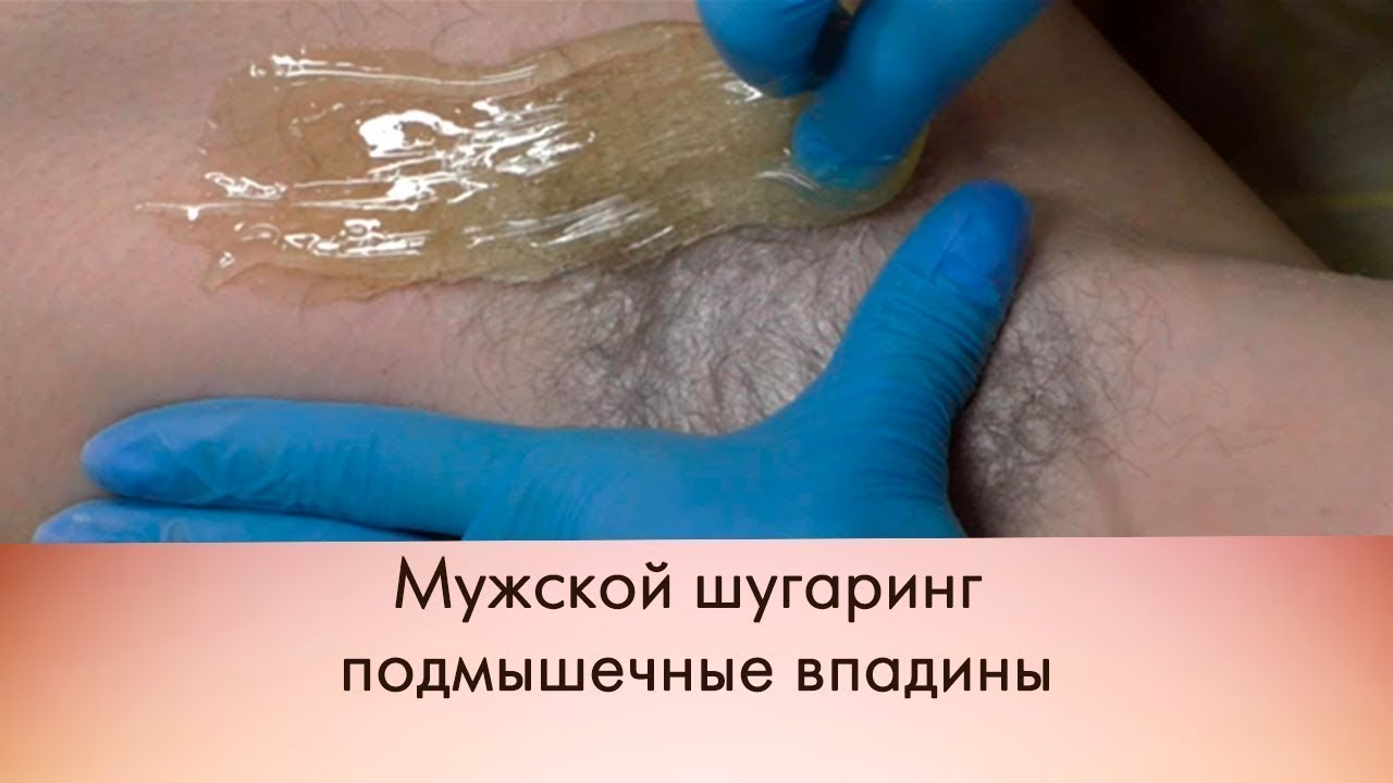 Что Такое Тотальное Бикини Фото