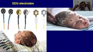 EEG: 3 (EEG electrode placements, EEG waves)