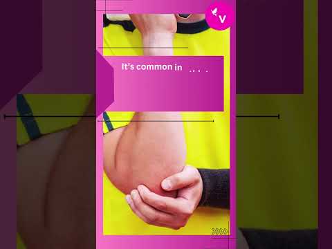 Unlock Tennis Elbow