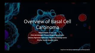 Basal Cell Carcinoma: What Patients Need to Know