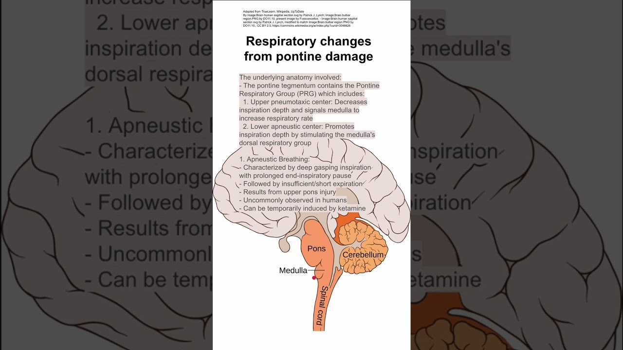 Respiratory changes from pontine damage