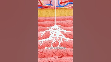 How Needle-Free Injections Actually Work 🤔