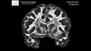 42. Diffusion Tractography: Goals of Tractography (Tract E1)