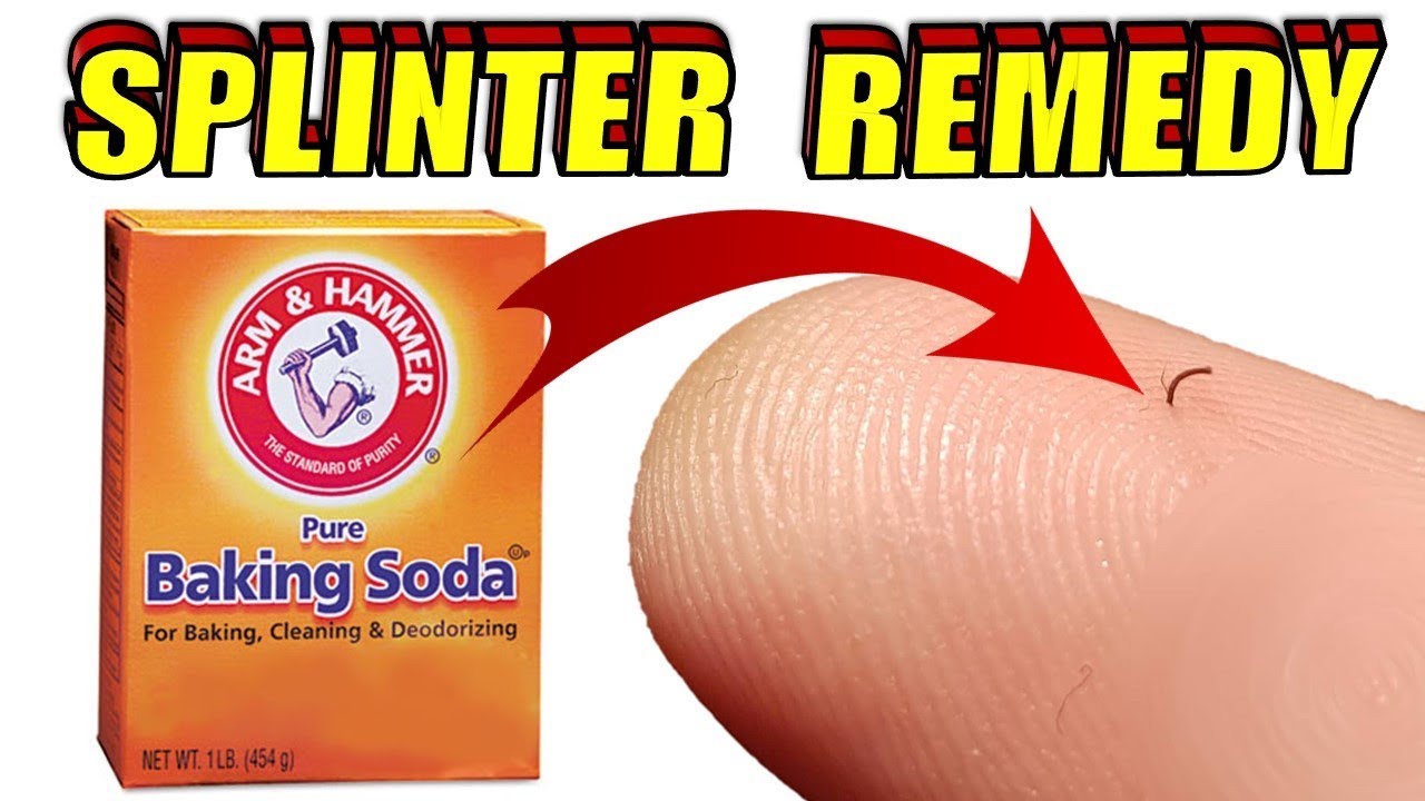 removal of fallopian tube How to Remove a Splinter With Baking Soda