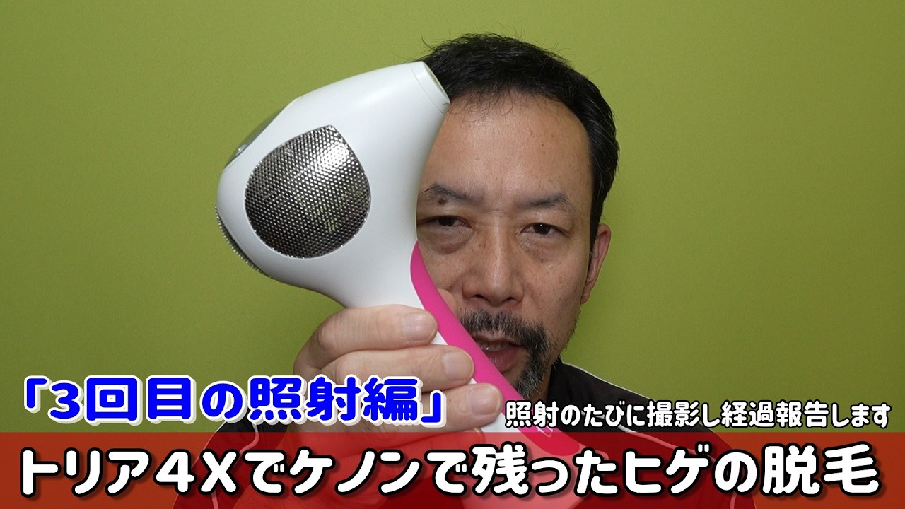 Removing stubborn beard hair left over after using Kenon with Tria