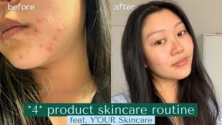 Skincare Routine to Get Rid of ACNE Y'our Skincare Review