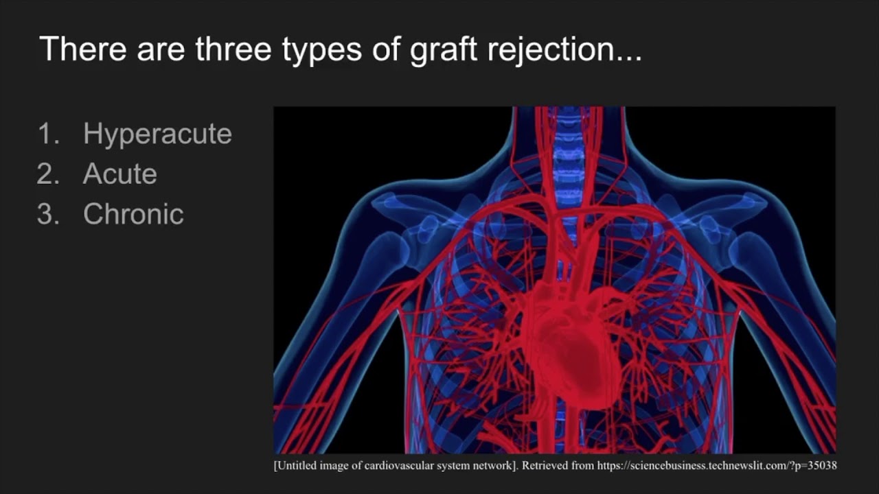 Best state for liver transplant picture