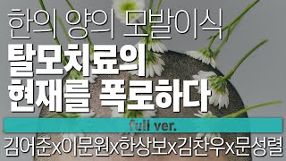 〔월말 김어준〕 한의 양의 모발이식, 탈모치료의 현재를 폭로하다. #풀버전