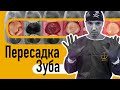 Пересадка зуба мудрости на место разрушенного // Ortodony