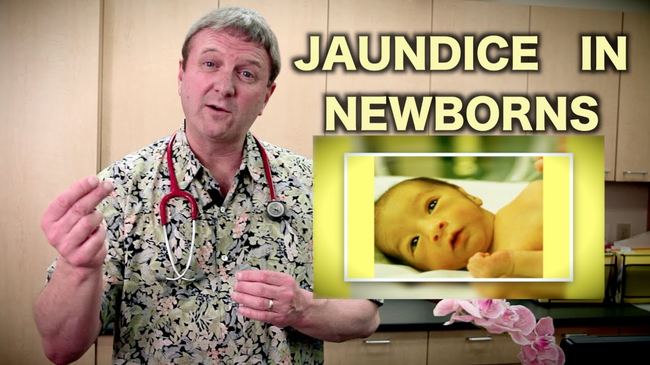 Jaundice In Newborns Pediatric Advice YouTube